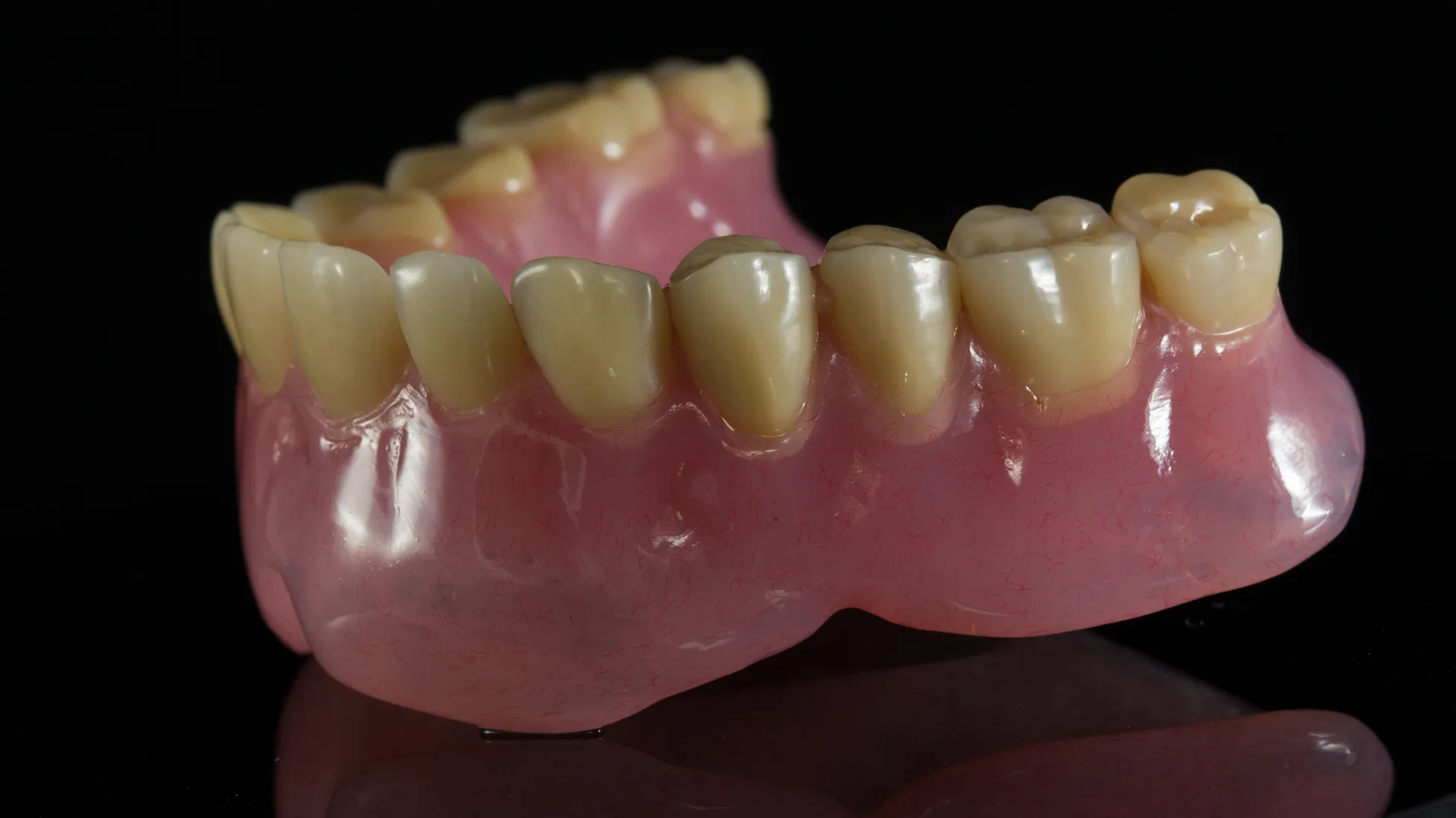 Vertex ThermoSens тотална протеза