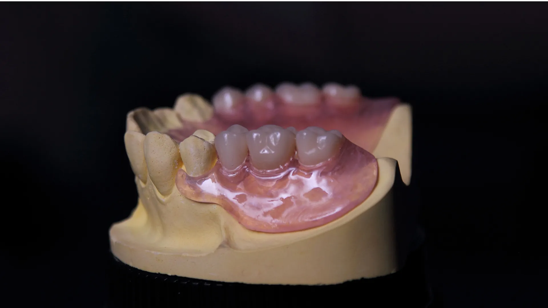 Vertex Thermosens TTRV
